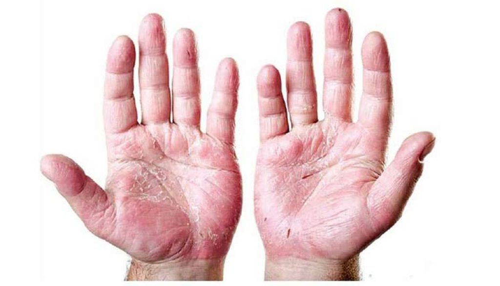 kustharog_DwLkASYarU