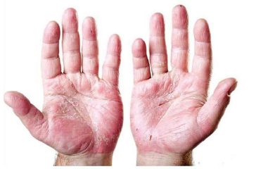 kustharog_DwLkASYarU