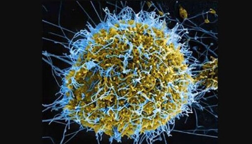 ebola-virus