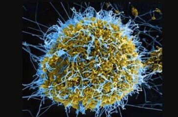 ebola-virus