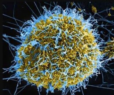 ebola-virus