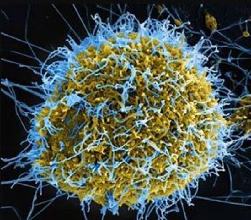 ebola-virus