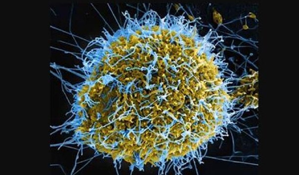 ebola-virus